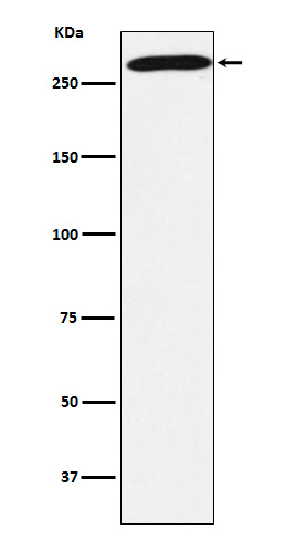 PRPF8 Rabbit mAb