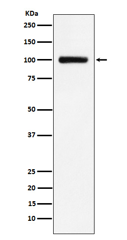 Transferrin Receptor 2 Rabbit mAb