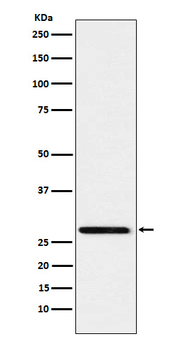 Peroxiredoxin 4  Rabbit mAb