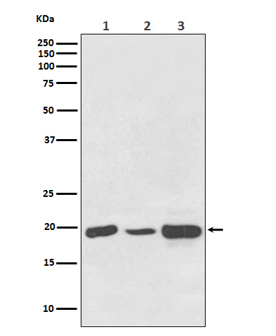 NDUFB8 Rabbit mAb