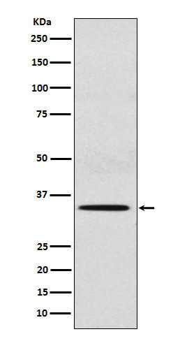 SULT2A1 Rabbit mAb