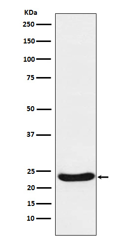 UQCRFS1 Rabbit mAb