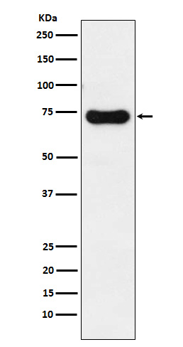 IRAK2 Rabbit mAb