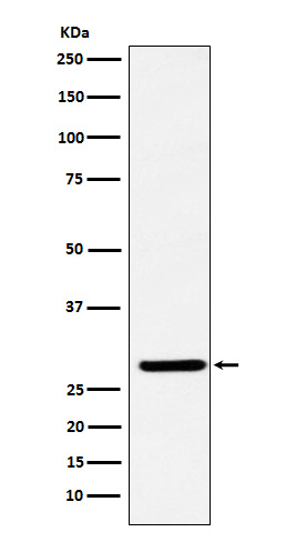 FHL2 Rabbit mAb