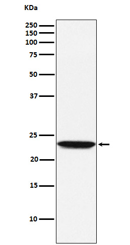 Tetranectin Rabbit mAb