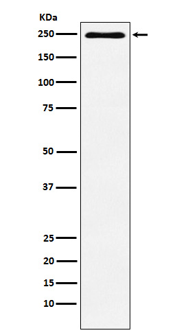 Plexin A1 Rabbit mAb