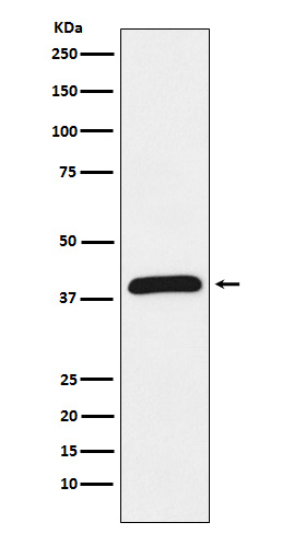 HIF1AN Rabbit mAb