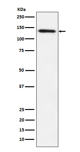 Lipin 1 Rabbit mAb