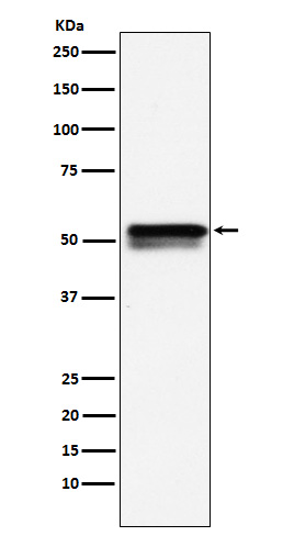 EGR2 Rabbit mAb