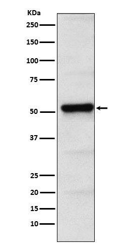 PICK1 Rabbit mAb