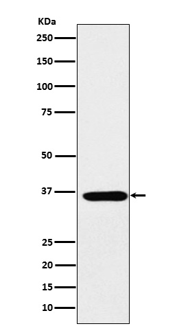 SMN1 Rabbit mAb