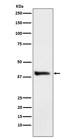 Alcohol Dehydrogenase Rabbit mAb