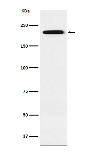 Gli3 Rabbit mAb