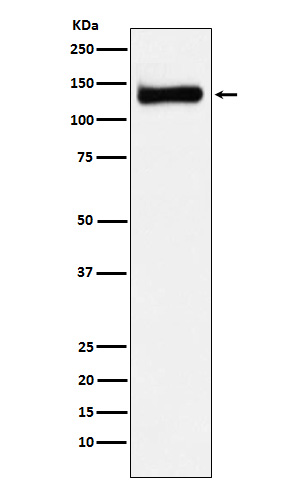 RENT1 / hUPF1 Rabbit mAb