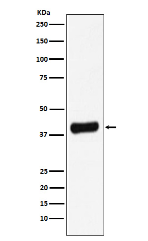 Galectin 8 Rabbit mAb