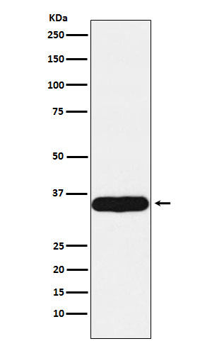 Tropomyosin 1 Rabbit mAb