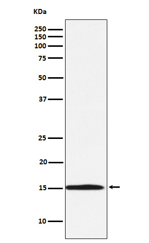 Ube2N / Ubc13 Rabbit mAb