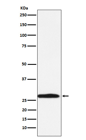 Carbonic Anhydrase 1 Rabbit mAb