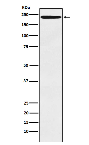 LY75 Rabbit mAb