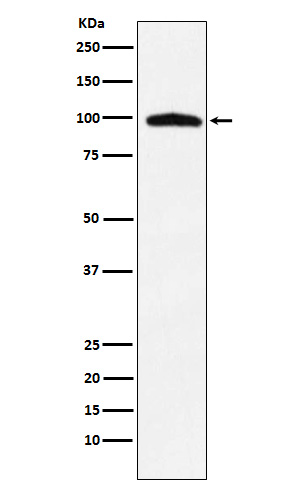 TNPO3 Rabbit mAb