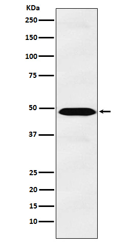 IL13 receptor alpha 1 Rabbit mAb