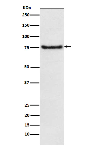 BDKRB2 Rabbit mAb