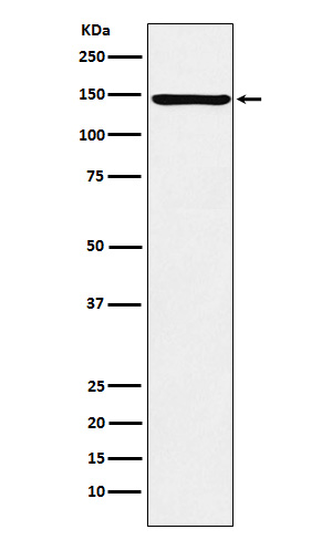 ORP150 Rabbit mAb