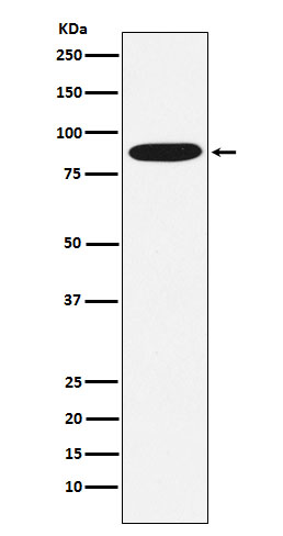 MST1 Rabbit mAb