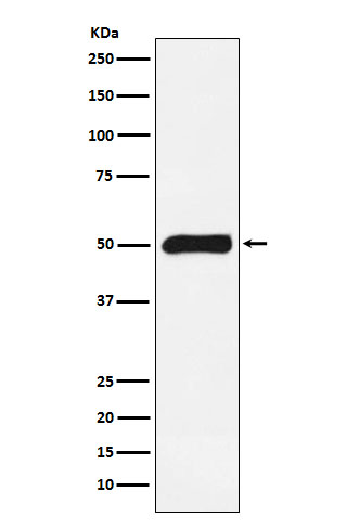 FKBP51 Rabbit mAb