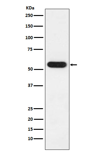 FKBP52 Rabbit mAb