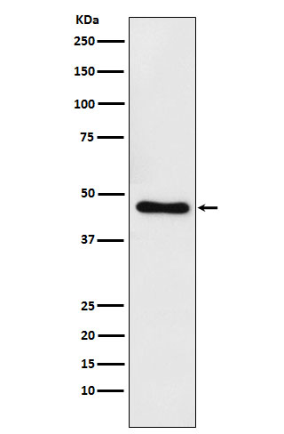 CtBP1 Rabbit mAb