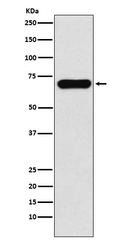 PCK1 Rabbit mAb