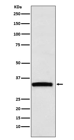 GDF15 Rabbit mAb