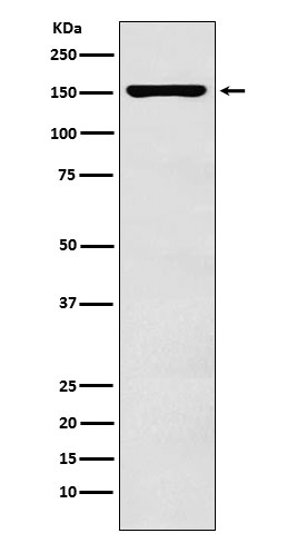 ADAR1 Rabbit mAb