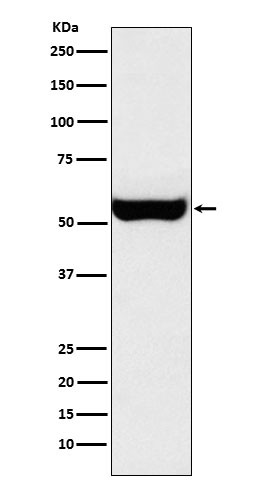 Monoamine Oxidase B Rabbit mAb