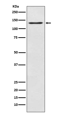 MGEA5 Rabbit mAb