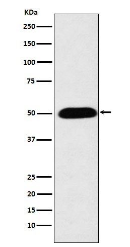 CYP27A1 Rabbit mAb