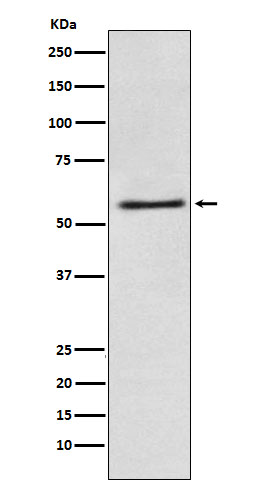 FAAH1 Rabbit mAb