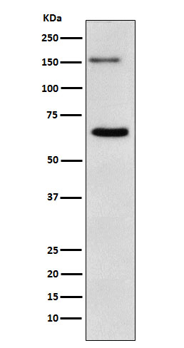 NUP153 Rabbit mAb