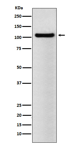 BRD2 Rabbit mAb