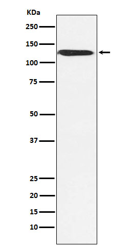 SNF2H Rabbit mAb