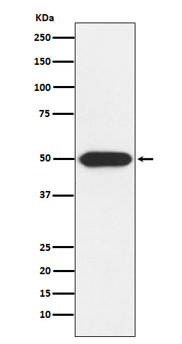 PRKAR1A Rabbit mAb