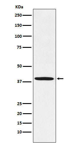 Fbx32 Rabbit mAb