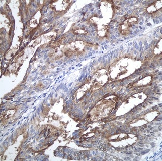 CA125 / MUC16 Rabbit mAb