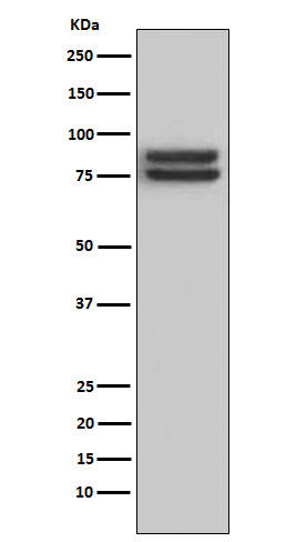 FOXP1 Rabbit mAb