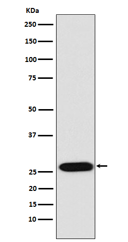 LIN28 Rabbit mAb