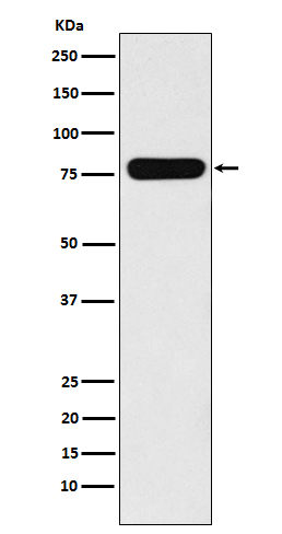 Villin-1  Rabbit mAb