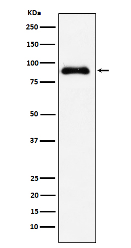 SATB2 Rabbit mAb