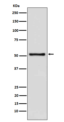 TDT Rabbit mAb