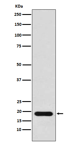 NM23 Rabbit mAb